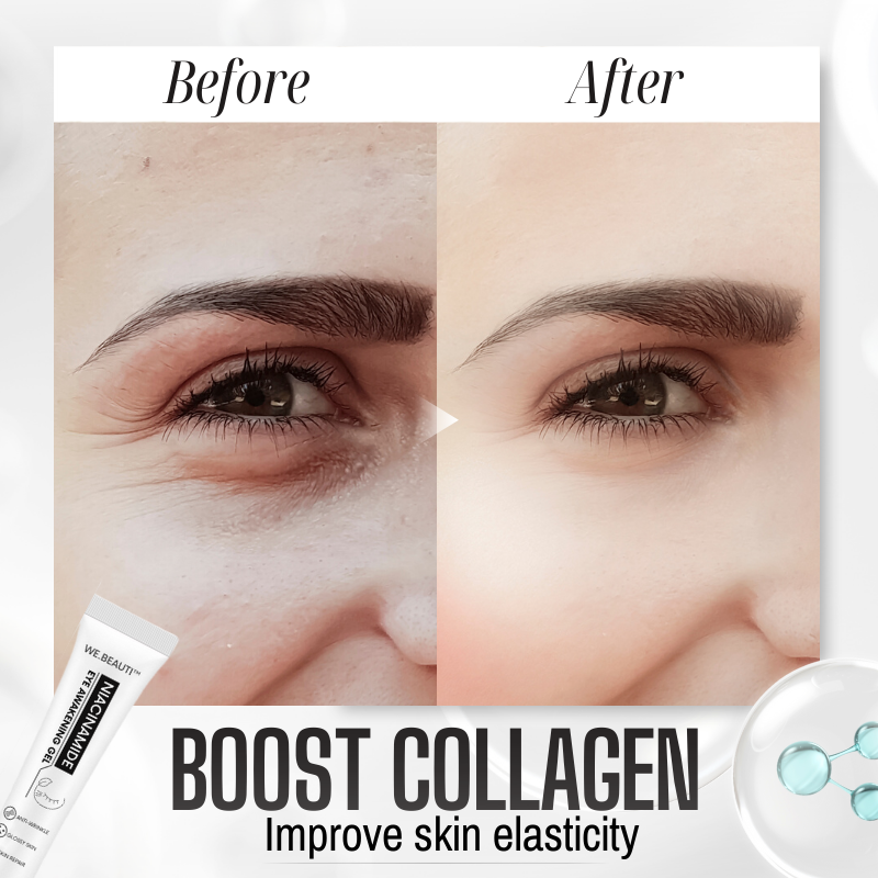 WE.Beauti™ Niacinamide Eye Awakening Gel