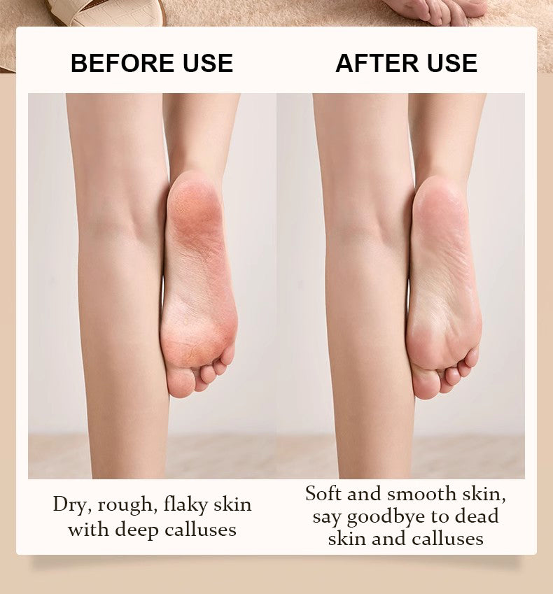 ( 💥Super Promotions )Nurbini™ Nano Crystal Exfoliating Pedicure