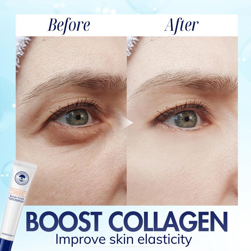 Dobshow™ Advanced Eye Retain Youth Cream