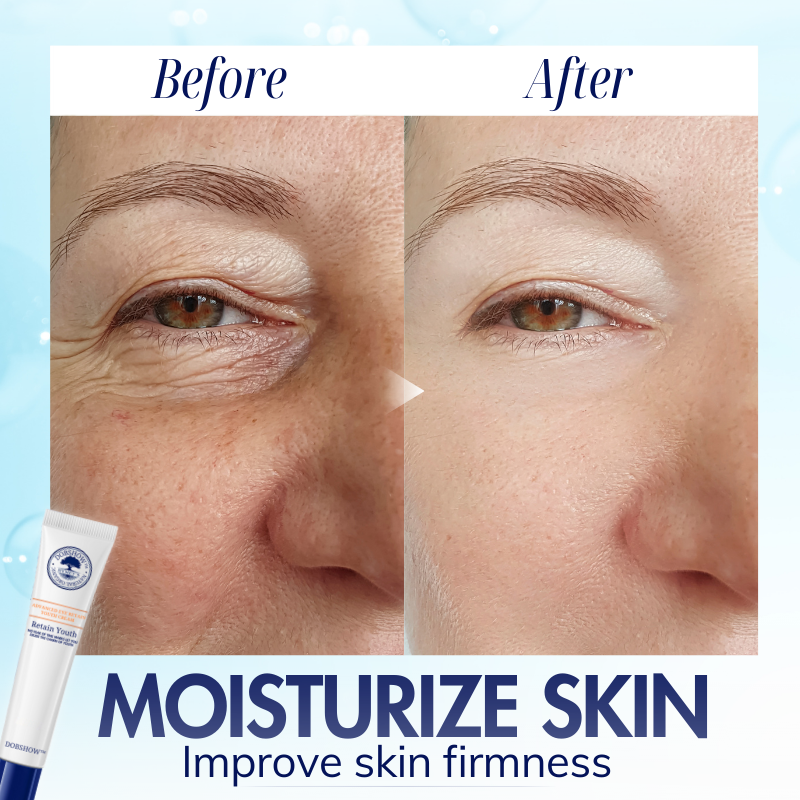 Dobshow™ Advanced Eye Retain Youth Cream