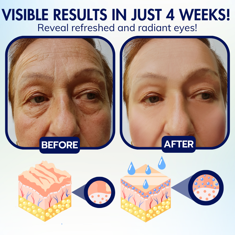 Dobshow™ Advanced Eye Retain Youth Cream
