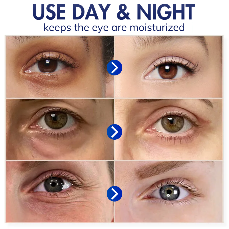 Dobshow™ Advanced Eye Retain Youth Cream