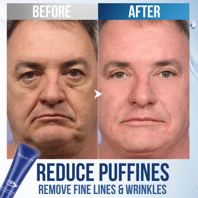 Rejuv-i™ Eyelid Firming Cream--