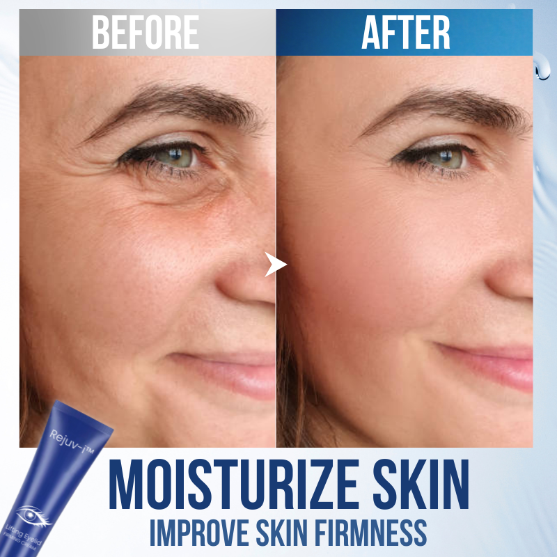 Rejuv-i™ Eyelid Firming Cream--