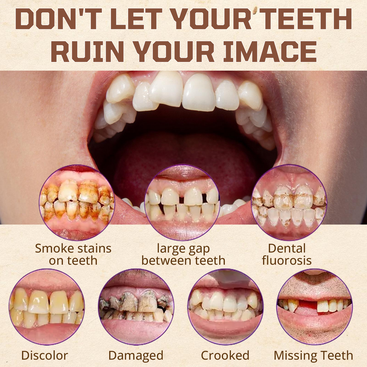 ✅ Official Store: Cvreoz® Adsorptive denture(⏰Limited time discount last 30 minutes⏰)