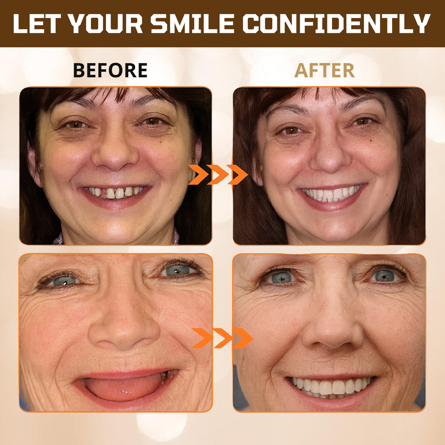 ✅ Official Store: Cvreoz® Adsorptive denture(⏰Limited time discount last 30 minutes⏰)