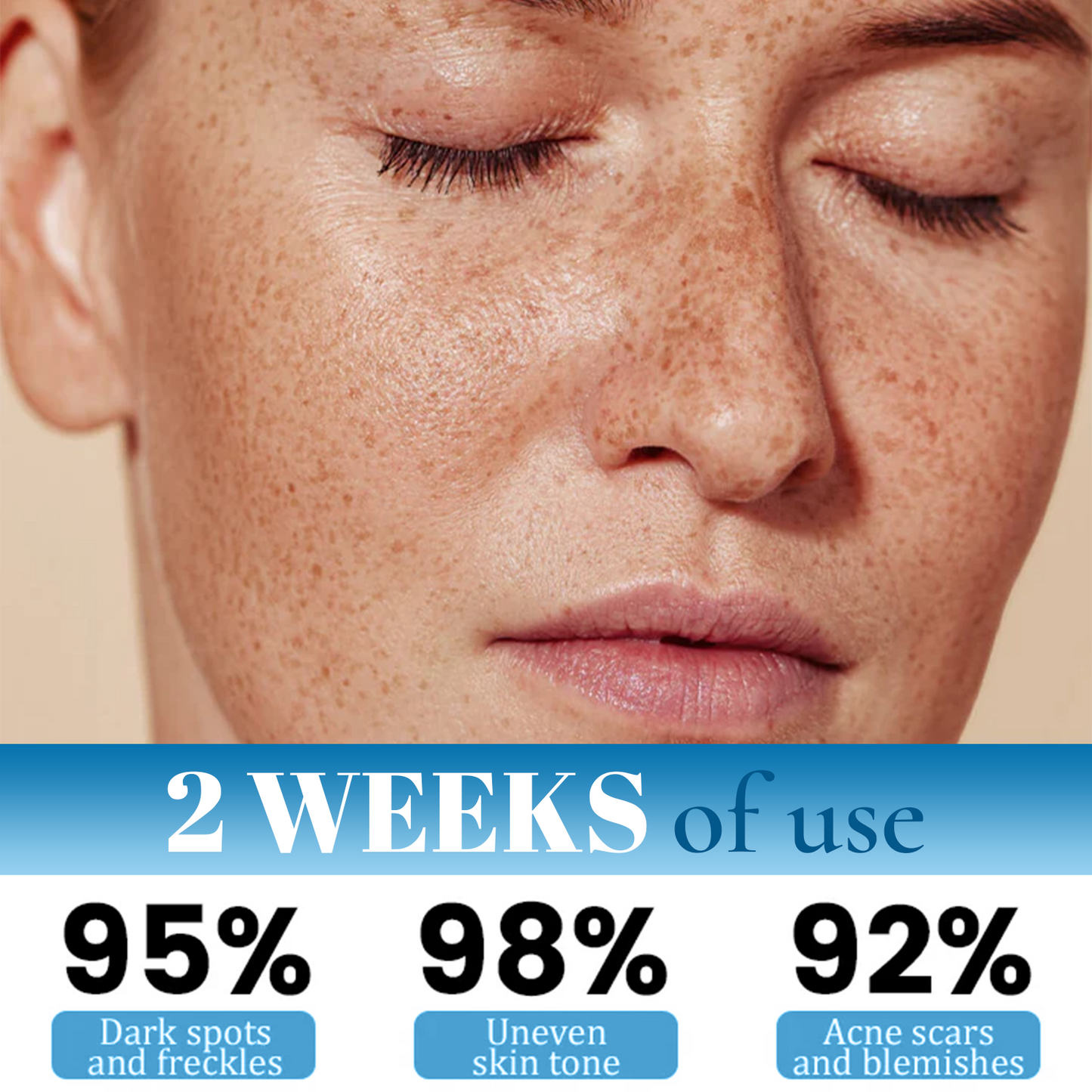 Cvreoz® MelantraX Advanced Anti-Hyperpigmentation Essence
