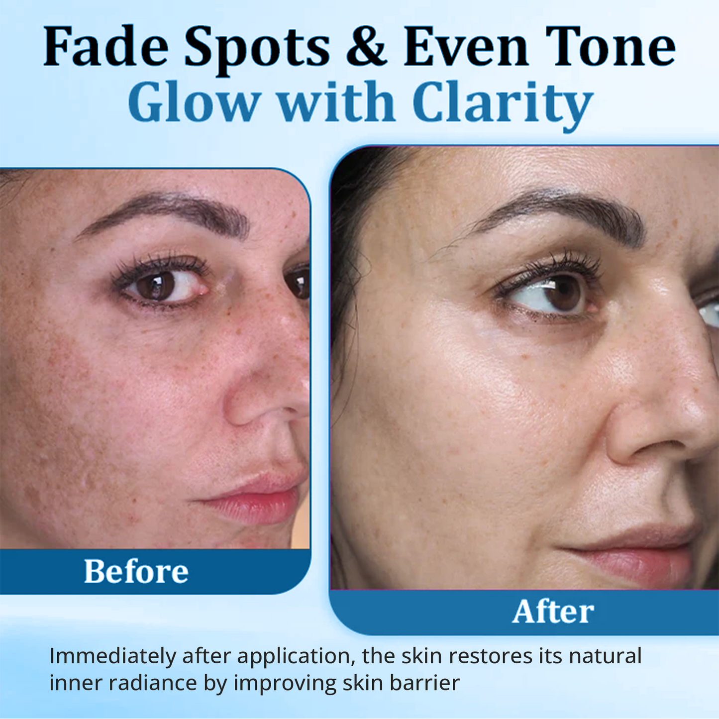 Cvreoz® MelantraX Advanced Anti-Hyperpigmentation Essence