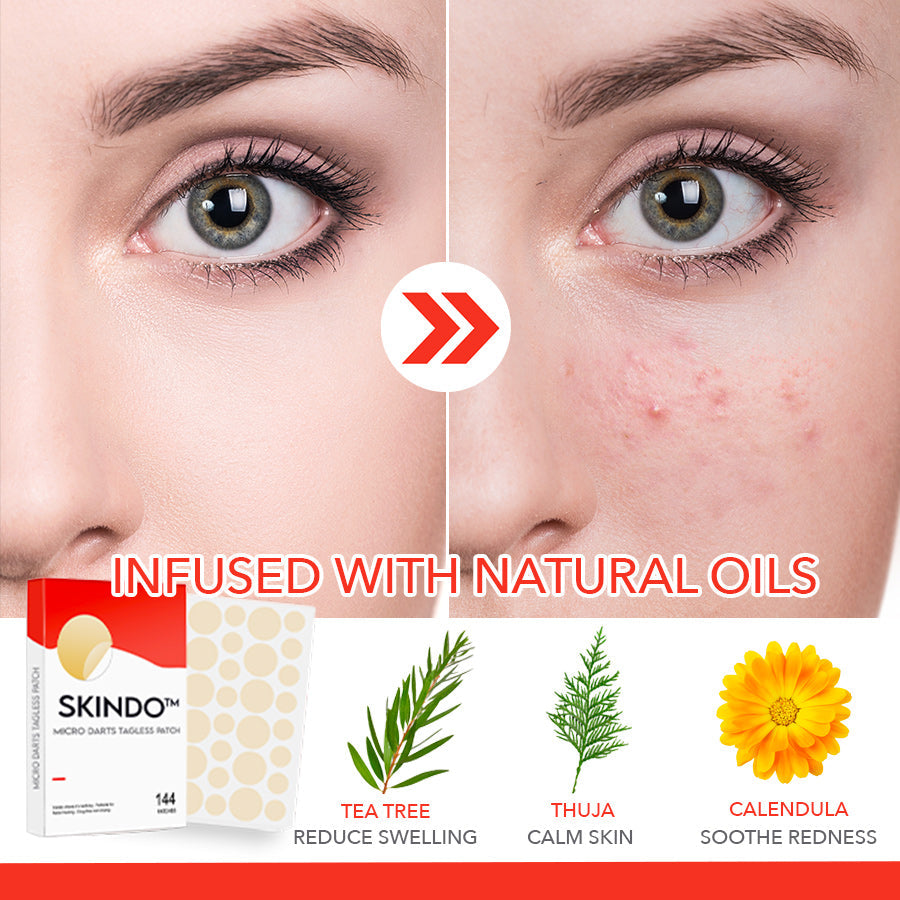 Skindo™ Micro Darts Tagless Patch