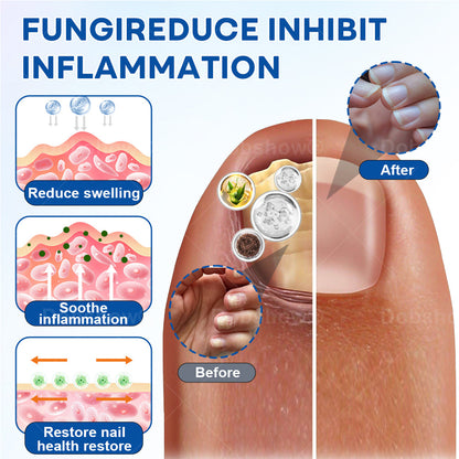 🔥Final 3 Hours: 80% OFF:AAFQ® Magnesium & Herbs Calming Spray