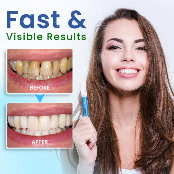 2026 Dobshow® Teeth Whitening Pen