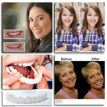 Nurbini™ ProX Adjustable Snap-On Dentures